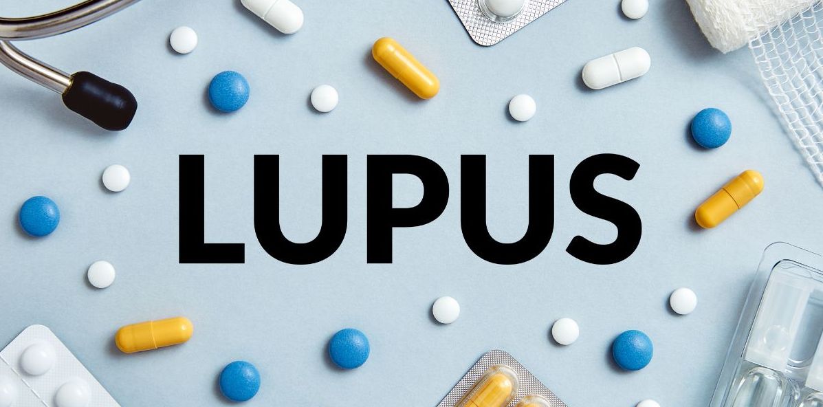  Exploring Promising New Treatments for Lupus: A Comprehensive Overview 